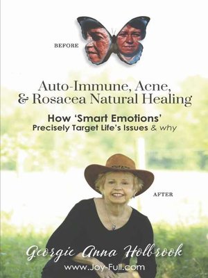 cover image of Auto-Immune, Acne, & Rosacea Natural Healing--How 'Smart Emotions' Precisely Target Life's Issues & Why